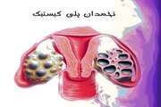 Risk factors for insulin resistance related to polycystic ovarian syndrome in Iranian population