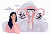 Hyperandrogenism and anthropometric parameters in women with polycystic ovary syndrome
