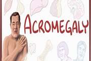 Predictors of biochemical and structural response to medical therapy in patients with active acromegaly following surgery: a real-world perspective