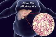 ارتباط تنگاتنگ دیابت و چاقی با کبد چرب غیر الکلی
