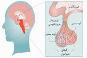   Short-term Assessment of HSCT Effects on the Hypothalamus-Pituitary Axis in Pediatric Thalassemic Patients.