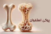 استخوان‌هایی که با یک عطسه می‌شکنند