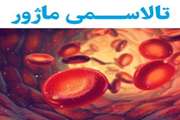 Investigating the status of height growth in patients with beta thalassemia major referred to the bone density measurement centers of the endocrinology research center of Tehran University of Medical Sciences in the years 2013 to 2014.