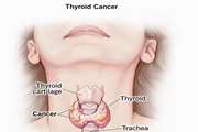 Design, synthesis, and cytotoxic evaluation of new quinazoline-1,2,3-triazole-N-phenylacetamide derivatives against thyroid cancer cell lines