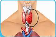 The trend of the incidence of thyroid cancers in the Iranian population during the years 2016-2022