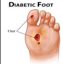 Diabetic foot care course: a quasi-experimental study on E-learning versus interactive workshop