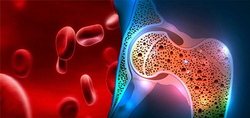 Association between serum hemoglobin level and bone mineral density in adults: Iranian multi-center osteoporosis study (IMOS)