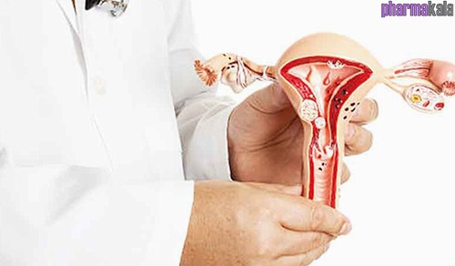 Effect of resveratrol administration on ovarian morphology, determined by transvaginal ultrasound for the women with polycystic ovary syndrome (PCOS)
