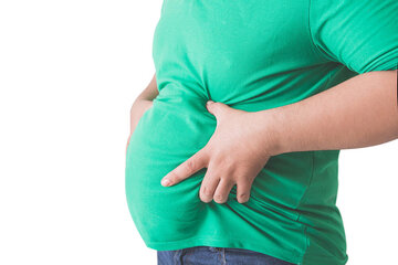 A multidisciplinary obesity registry for Iranian adults a protocol