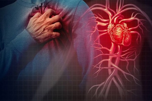 Subgroups With Metabolic Syndrome Show Different Association With Ischemic Heart Disease and Stroke Findings of Iran STEPS Survey 2021