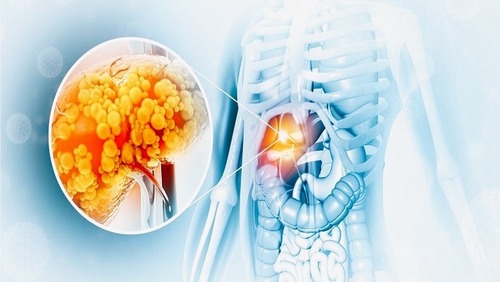 The association between dietary consumption of amino acids and the risk of non-alcoholic fatty liver disease: a case-control study