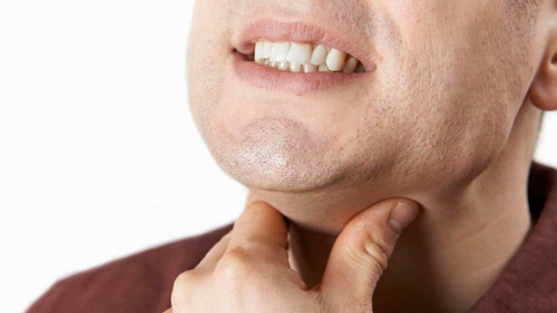 Are thyroid problems associated with sore throat