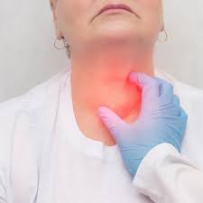 inflammation of the thyroid thyroiditis