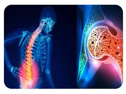 Using bone mineral apparent density for BMD adjustment in chronic diseases: Thalassemia an example 